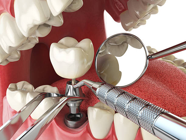 Best Emergency Denture Repair in Sleepy Hollow, WY